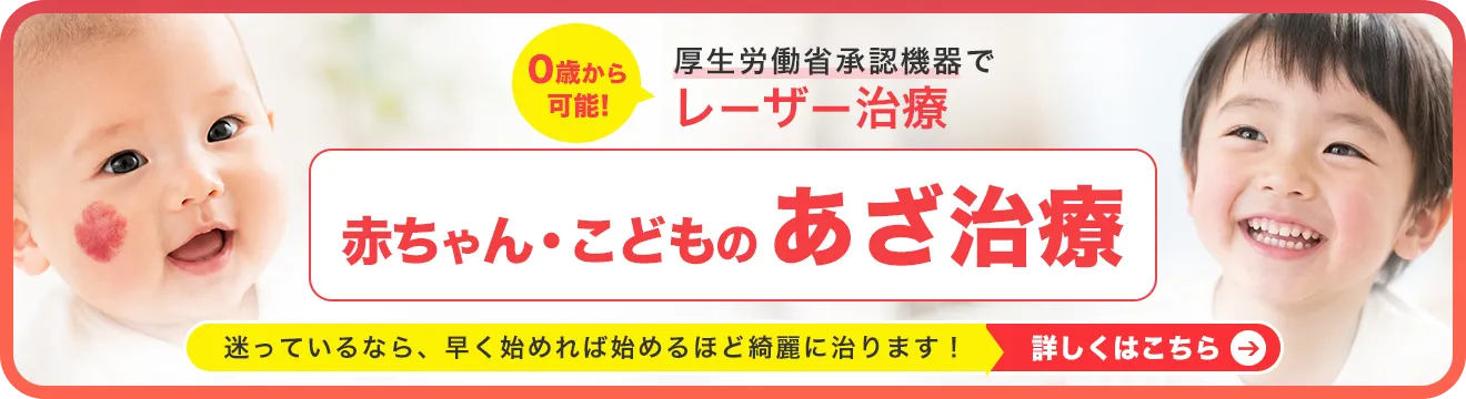 赤ちゃん・こどものあざ治療